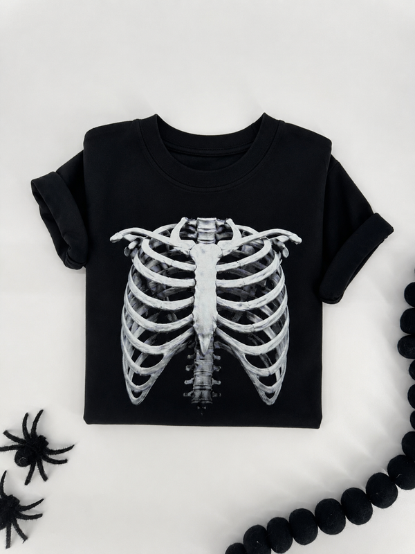 X-Ray
